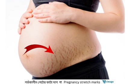 Juda chiroyli qizning seks video